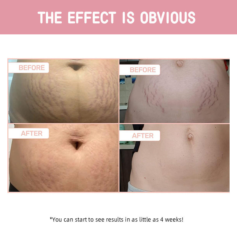 B-Flat ™ Tightening Cream Moisturizing Lifting Light Lines Firming Skin Body Cream