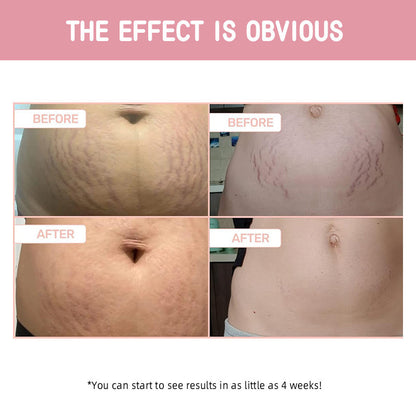 B-Flat ™ Tightening Cream Moisturizing Lifting Light Lines Firming Skin Body Cream