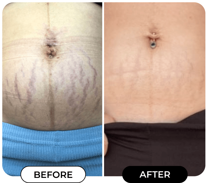 Dream Cream™ Body Shaping Lifting And Firming Cream