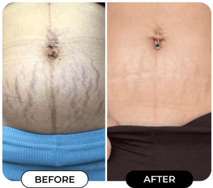 Dream Cream™ Body Shaping Lifting And Firming Cream